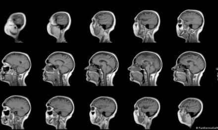 Escáneres cerebrales identifican seis tipos distintos de depresión y ansiedad