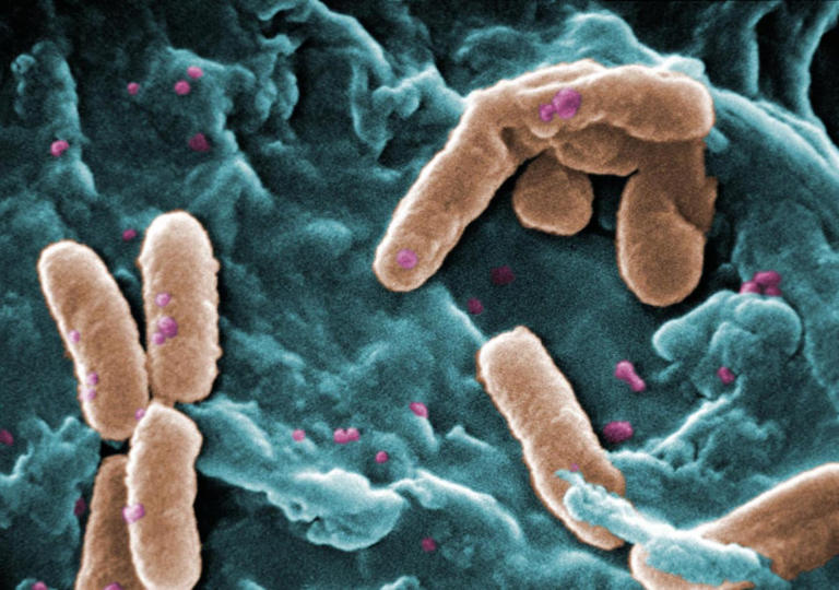 Identifican los orígenes de una peligrosa bacteria, capaz de causar 300.000 muertes al año